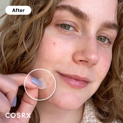 COSRX Acne Pimple Patch hydrocolloid closeup shows moisture-friendly healing support