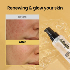 coxir INTENSIVE EGF PEPTIDES SERUM swirl on skin suggests plumping and smoother texture.