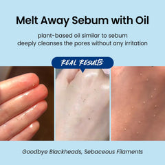 Coxir Ultra Hyaluronic Cleanser supports clear pores with a gentle, non-stripping cleanse.