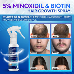 DABIDA Minoxidil women application showcases easy at-home growth routine.