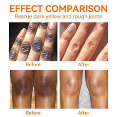 Dark Knees Remover packaging image emphasizes convenient home care.