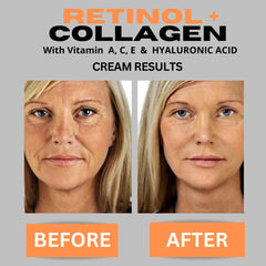 DERMA CLINICALS face-cream texture-swirl shows smooth, comfortable application.