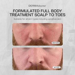 DERMAdoctor face wash lather close-up, showcasing rich foam for gentle cleansing