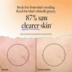 Derma E Acne Deep Pore Cleansing Wash ingredients highlight tea tree oil for soothing care.