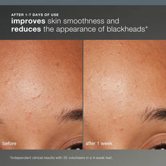 Dermalogica Daily Microfoliant wet-to-paste texture provides gentle polishing