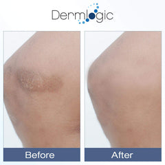 Dermlogic Vitamin K Cream fine-lines-use provides hydration for smoother-looking skin.