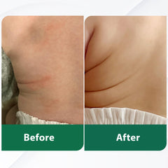 DERMOIA Moisturizer applied to elbow and hand showing hydration for dry areas.