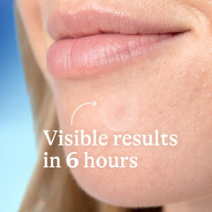 Differin small and large patches side-by-side for size-specific blemish coverage