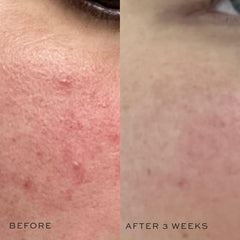 DIME Beauty Super Skin Toner application with cotton pad showcases easy daily use.
