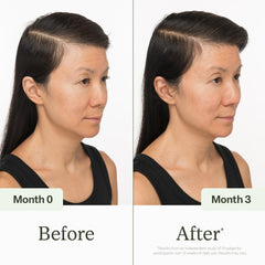 Divi Scalp Serum no-residue finish on scalp after application.