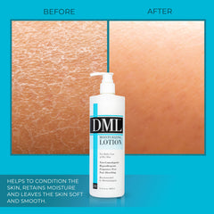 DML Moisturizing Lotion texture close-up shows fast absorption for comfortable skin.