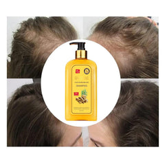 Dosoecse Ginaday Ginger Shampoo scalp-care shot implies nourishment for hair.