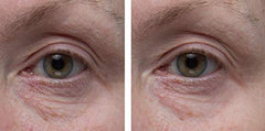 Dr. Denese SkinScience Firming Eye Cream under-eye application shows gentle lift.