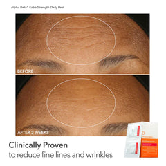 Dr Dennis Gross Peel Vault Kit 90 treatments highlights customized at-home regimen