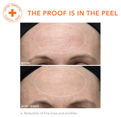 Dr Dennis Gross Alpha Beta Ultra Gentle Daily Peel two-step packaging for at-home routine convenience.
