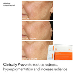 Dr Dennis Gross Universal Daily Peels tubes for everyday radiance and smoothing