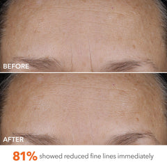 Dr Dennis Gross DermInfusions elasticity support shown in close‑up on skin texture.