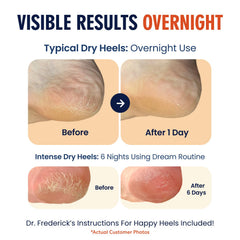 Dr. Frederick's Original breathable toeless heel socks highlight comfortable fit.