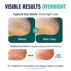 Dr. Frederick's Original Heel Socks show breathable fabric for comfortable wear.