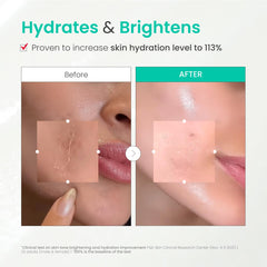Dr.G Brightening Peeling Gel with hyaluronic acid delivers hydration during exfoliation