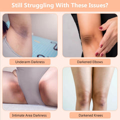 DR.Afanyr Skin Bleaching Cream underarms close-up highlighting brightness and even tone