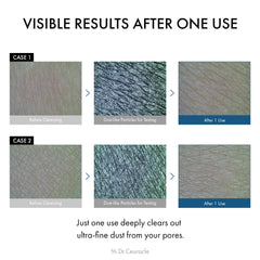 Dr.Ceuracle Pro Balance Enzyme Powder Wash pour demonstrates easy application for quick cleansing.