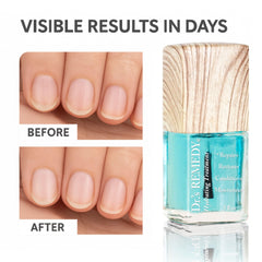 Dr.'s Remedy Caress Cuticle Oil bottle conveys gentle nourishment for healthy cuticles.
