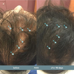 Close-up of Revita.SOD tablet highlighting compact texture ideal for daily hair wellness