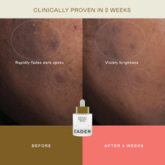 EADEM Amber Algae ingredient highlight supporting balanced skin texture