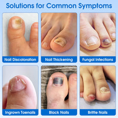 Closeup of applying an EASICUTI patch to a toenail for overnight use.