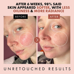 Eclat Skincare Rose Water Toner ingredients close-up highlights rose, hyaluronic acid, and aloe