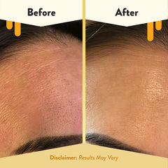 ECZEMA HONEY Nourishing Serum on skin conveys soft glow and immediate hydration