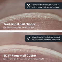 EDJY Fingernail Cutter safety stop helps prevent over-cutting and keeps nails intact