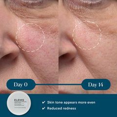Elemis Dynamic Resurfacing Pads textured side closeup showing precise exfoliation for brightness.