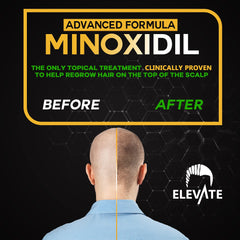 Elevate 5% Minoxidil box packaging highlights the extra-strength formula and usage