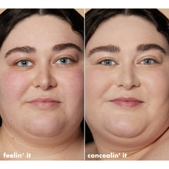 e.l.f. Hydrating Camo Concealer masking blemishes with a satin finish.