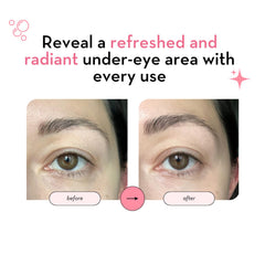 Elizabeth Mott 24K Gold Under Eye Patches applied under eyes deliver cooling de-puffing support