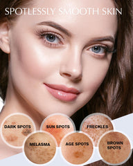 EnaSkin applying dark spot remover on skin for clearer tone.