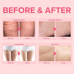 Enaskin Naturals tightening lotion for stomach and midsection tightens loose skin.