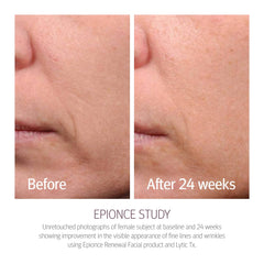 Epionce Renewal Facial Lotion ingredients close-up highlights key actives