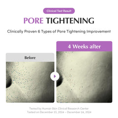EQQUALBERRY Purple PDRN Serum packaging communicates clean, premium Korean skincare routine.