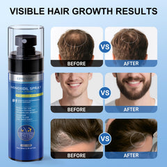 ERWCNMIE biotin-castor-oil-panthenol formula supports nourished hair appearance.
