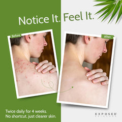 Exposed Skin Care body wash lather closeup showing gentle exfoliation and refreshing rinse