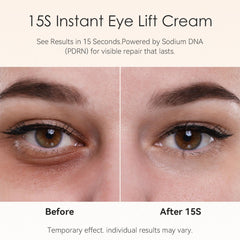 Fankr Sodium DNA renewal highlights renewal support for tired-looking eyes.