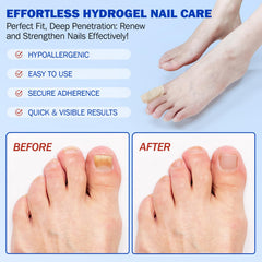 Fanshi Nail Patches applied to toe during bedtime for repair potential