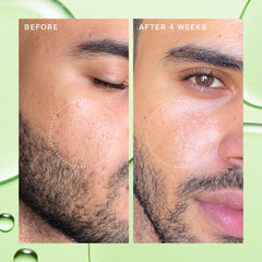 Farmacy 2% Toner moringa water close-up showing soothing balance.