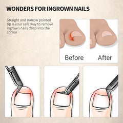 FERYES clipper 120° slant aids easier trimming of thick nails
