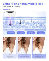 Finequin Air 15 auto-glide mode enables faster hair removal across large areas.