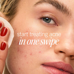 First Aid Beauty acne pads 2percent salicylic acid pad detail for targeted acne care