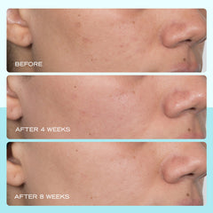First Aid Beauty application shot demonstrates quick, smooth layering into routine.